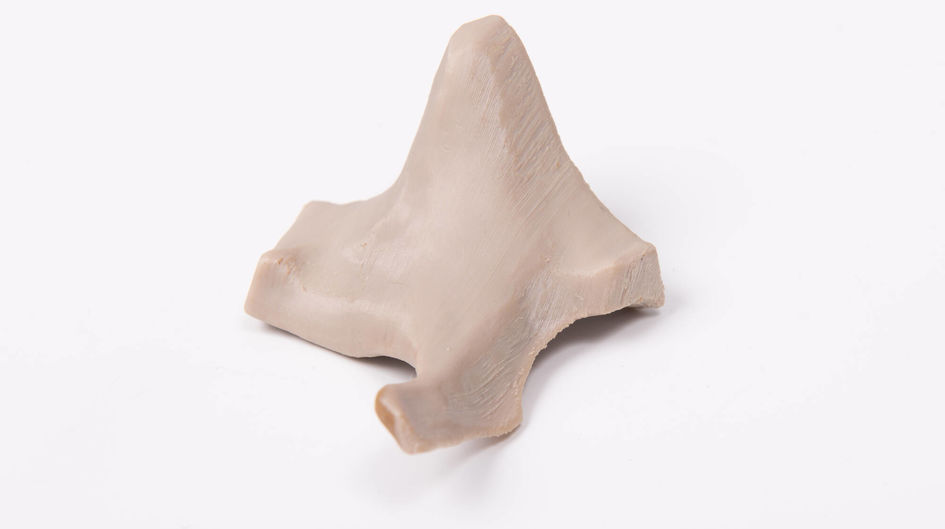 3D printed cheekbone implant based on VESTAKEEP® i4 3DF implante grade PEEK filamen